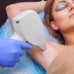 woman-having-laser-hair-removal-on-her-armpit
